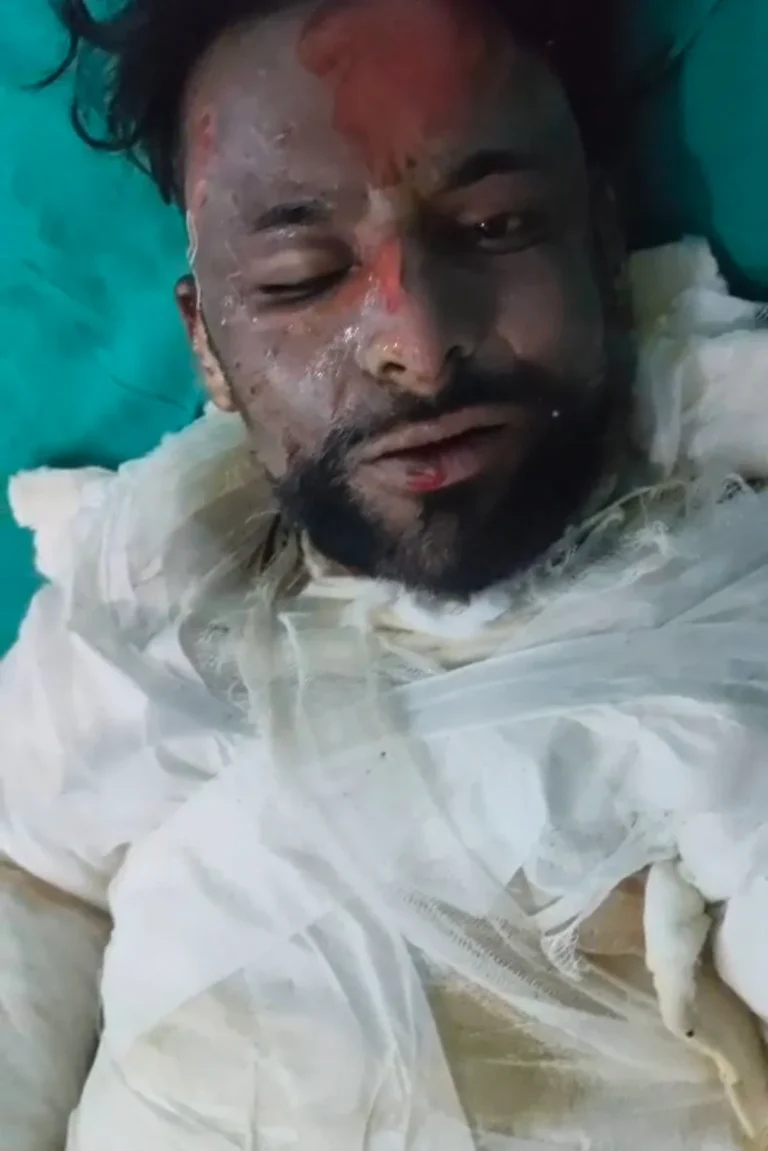 बरेली: बीवी से विवाद के बाद मुअज्जिन ने खुद को लगाई आग, इलाज के दौरान मौत; वायरल वीडियो से मामले में नया मोड़ बरेली। फतेहगंज पश्चिमी कस्बे के मोहल्ला अंसारी स्थित हुसैनी मस्जिद के मुअज्जिन अब्दुल कादिर की आग से झुलसने के बाद इलाज के दौरान बुधवार को मौत हो गई। बताया जा रहा है कि मंगलवार को घरेलू विवा